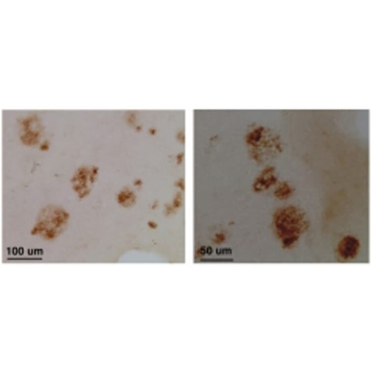Validation Data - Anti-CLAC-P Antibody - BSA and Azide free (A304660)