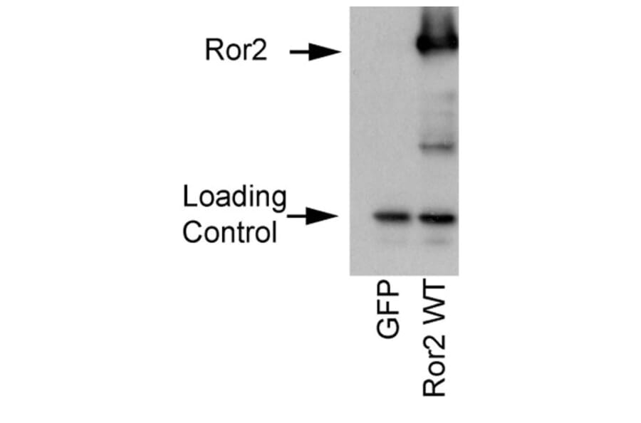 Validation Data - Anti-ROR2 Antibody [ROR2 2535-2835] - BSA and Azide free (A304668)