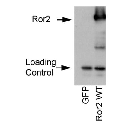 Validation Data - Anti-ROR2 Antibody [ROR2 2535-2835] - BSA and Azide free (A304668)