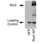 Validation Data - Anti-ROR2 Antibody [ROR2 2535-2835] - BSA and Azide free (A304668)