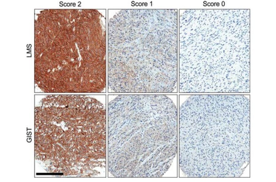 Validation Data - Anti-ROR2 Antibody [ROR2 2535-2835] - BSA and Azide free (A304668)