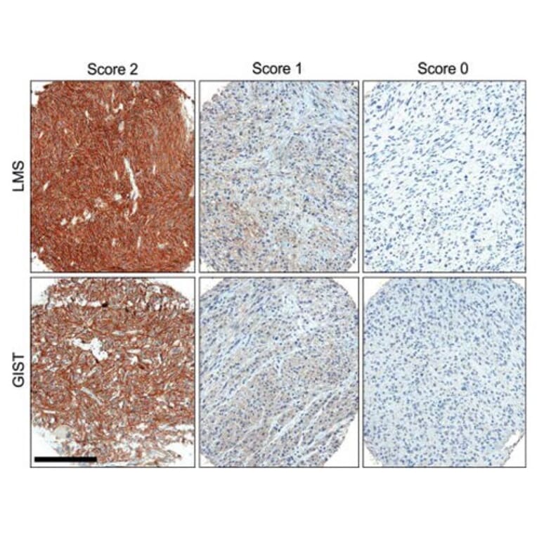 Validation Data - Anti-ROR2 Antibody [ROR2 2535-2835] - BSA and Azide free (A304668)
