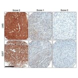 Validation Data - Anti-ROR2 Antibody [ROR2 2535-2835] - BSA and Azide free (A304668)