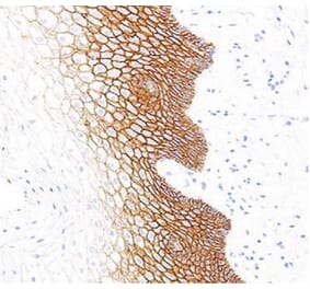 Validation Data - Anti-E-Cadherin Antibody [G564.1] (A304674)