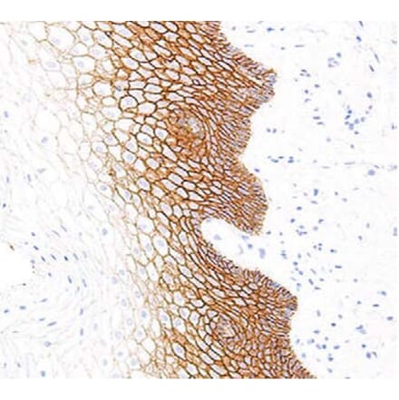 Validation Data - Anti-E-Cadherin Antibody [G564.1] (A304674)