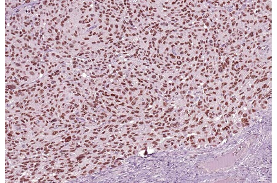 Validation Data - Anti-SOX-10 Antibody [G010.1] (A304690)