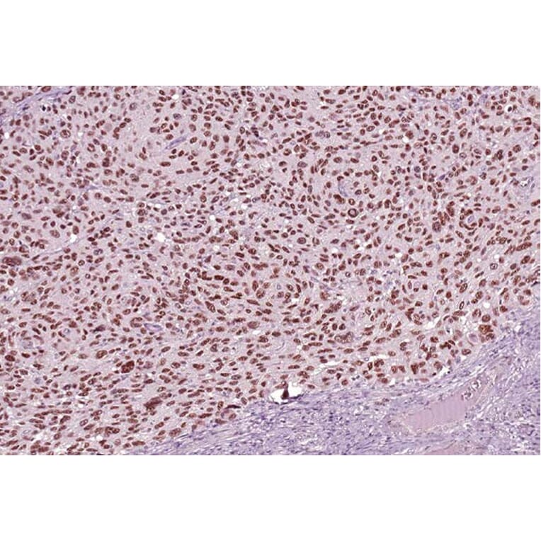 Validation Data - Anti-SOX-10 Antibody [G010.1] (A304690)