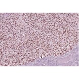 Validation Data - Anti-SOX-10 Antibody [G010.1] (A304690)