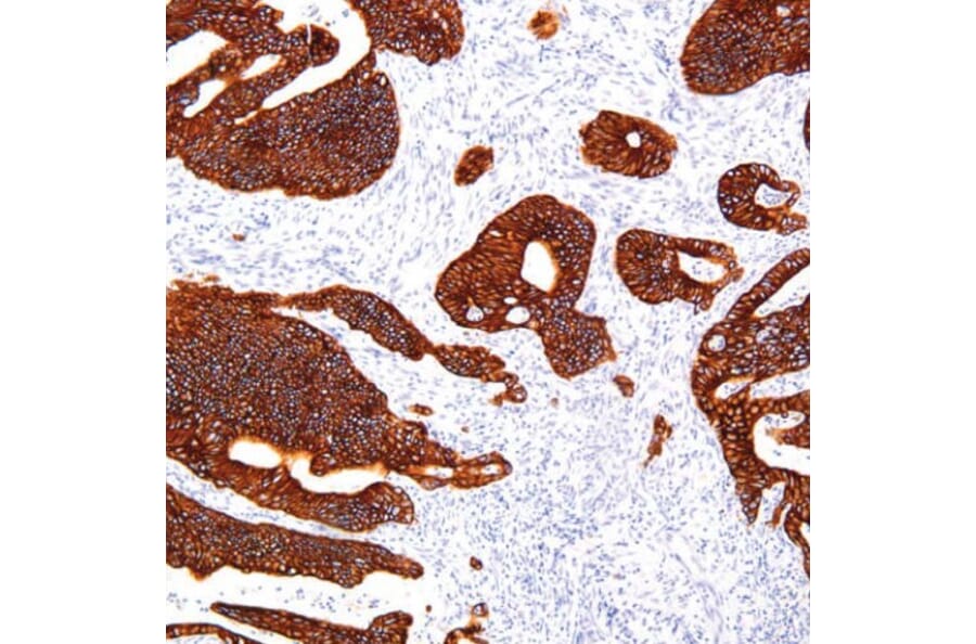 Validation Data - Anti-Cytokeratin 18 Antibody [G018.1] (A304691)