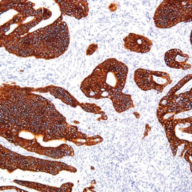 Validation Data - Anti-Cytokeratin 18 Antibody [G018.1] (A304691)