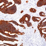 Validation Data - Anti-Cytokeratin 18 Antibody [G018.1] (A304691)