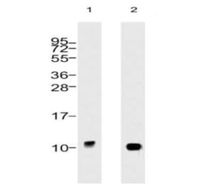 Validation Data - Anti-Ubiquitin Antibody [5B9.B3] - BSA and Azide free (A304692)