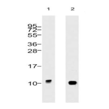 Validation Data - Anti-Ubiquitin Antibody [5B9.B3] - BSA and Azide free (A304692)