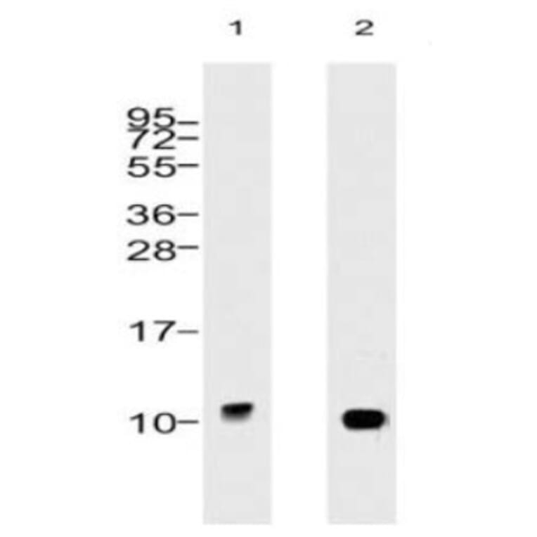 Validation Data - Anti-Ubiquitin Antibody [5B9.B3] - BSA and Azide free (A304692)