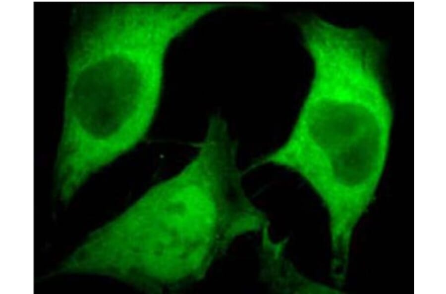 Validation Data - Anti-Ubiquitin Antibody [5B9.B3] - BSA and Azide free (A304692)