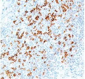 Validation Data - Anti-PD-1 Antibody [G001.1] (A304695)