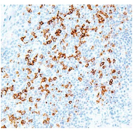 Validation Data - Anti-PD-1 Antibody [G001.1] (A304695)