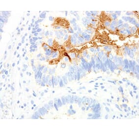 Validation Data - Anti-TAG-72 Antibody [G072.1] (A304697)