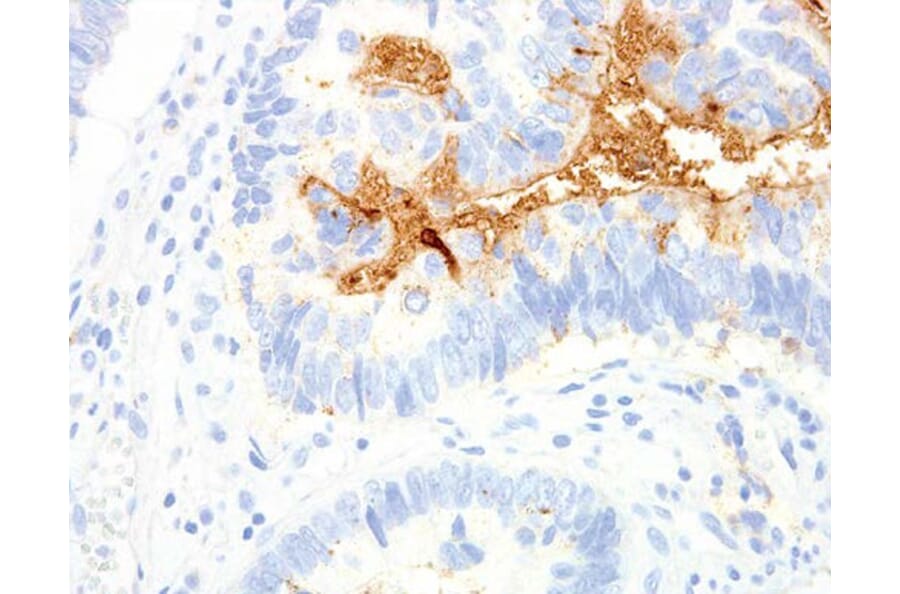 Validation Data - Anti-TAG-72 Antibody [G072.1] (A304697)