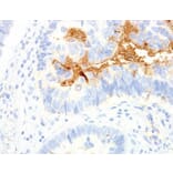 Validation Data - Anti-TAG-72 Antibody [G072.1] (A304697)