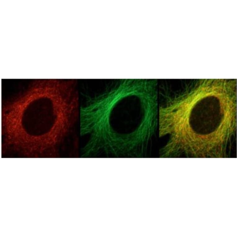 Validation Data - Anti-ch-TOG Antibody (A304698)