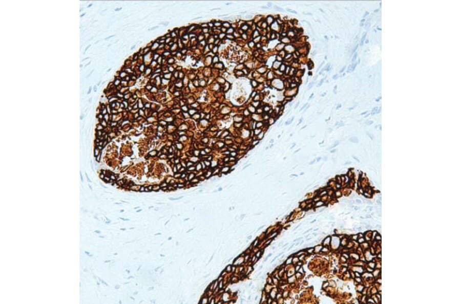 Validation Data - Anti-Her2 Antibody [G002.1] (A304699)