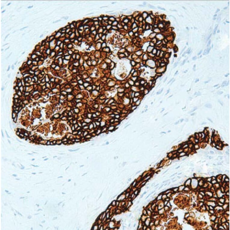 Validation Data - Anti-Her2 Antibody [G002.1] (A304699)