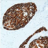 Validation Data - Anti-Her2 Antibody [G002.1] (A304699)
