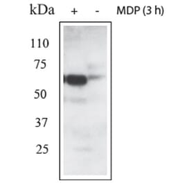 Validation Data - Anti-RIPK2 Antibody (A304700)
