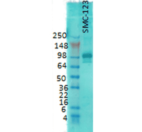 Western Blot - Anti-PSD95 Antibody [7E3] (A304702) - Antibodies.com