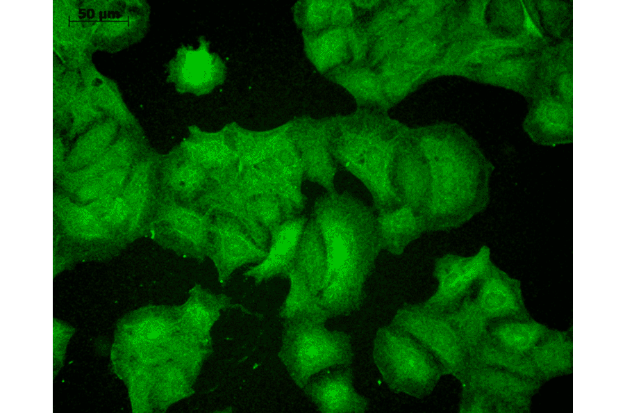 Immunocytochemistry/Immunofluorescence - Anti-PSD95 Antibody [7E3] (A304702) - Antibodies.com