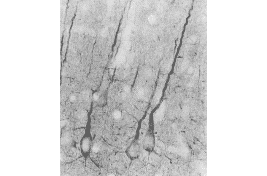 Immunohistochemistry - Anti-PSD95 Antibody [7E3] (A304702) - Antibodies.com