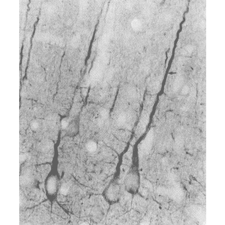 Immunohistochemistry - Anti-PSD95 Antibody [7E3] (A304702) - Antibodies.com
