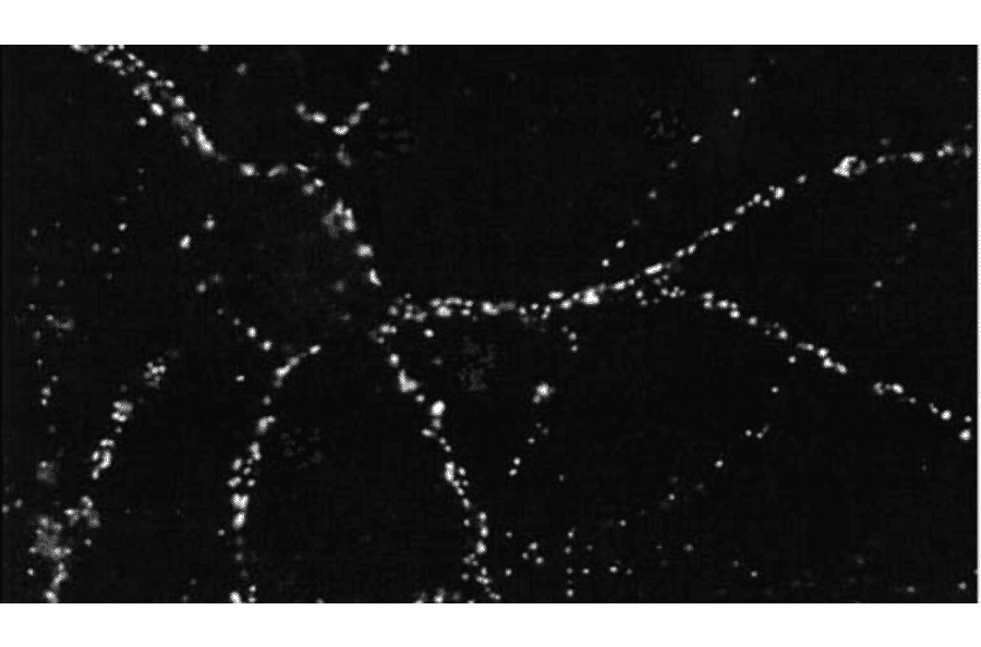 ICC/IF of rat hippocampal neurons using Anti-PSD95 [6G6] Antibody (A304703)