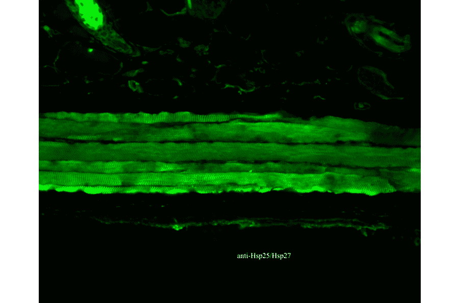 Immunohistochemistry - Anti-HSP27 Antibody [8A7] (A304709) - Antibodies.com