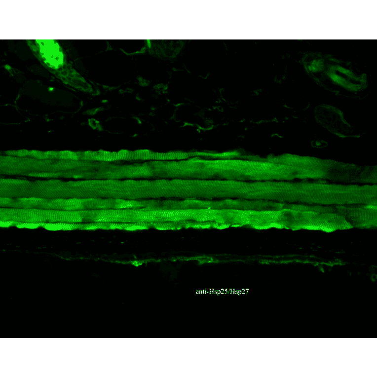 Immunohistochemistry - Anti-HSP27 Antibody [8A7] (A304709) - Antibodies.com
