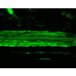 Immunohistochemistry - Anti-HSP27 Antibody [8A7] (A304709) - Antibodies.com
