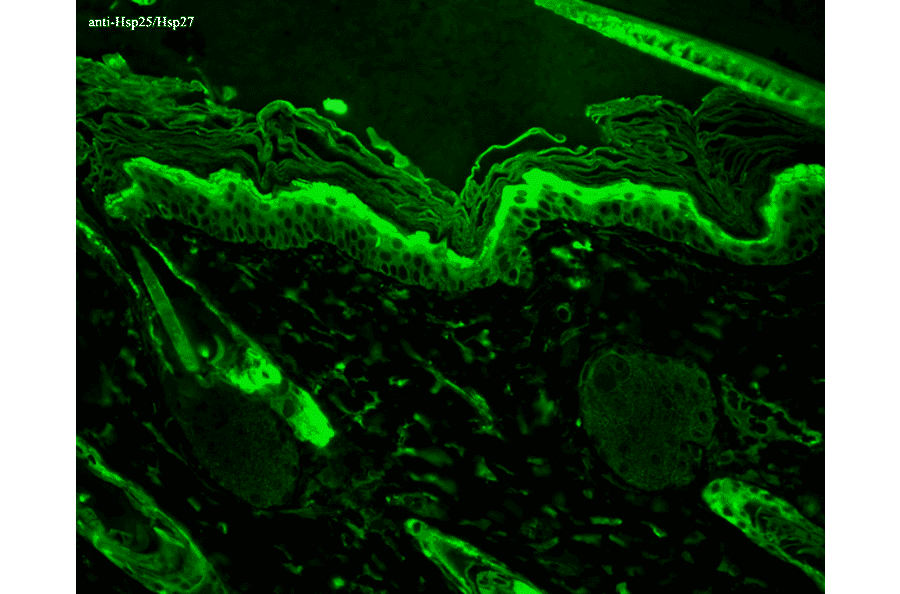 Immunohistochemistry - Anti-HSP27 Antibody [8A7] (A304709) - Antibodies.com