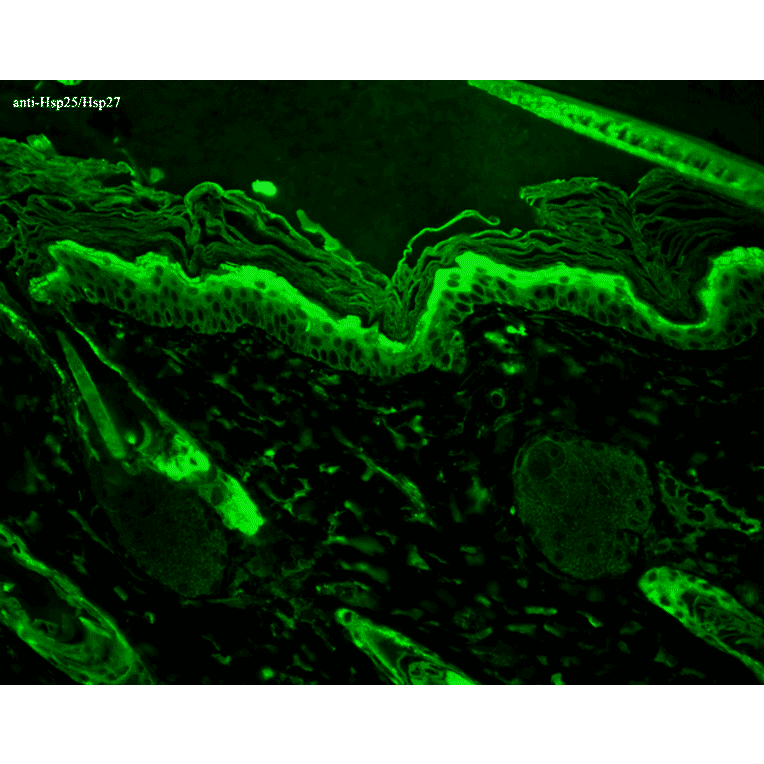 Immunohistochemistry - Anti-HSP27 Antibody [8A7] (A304709) - Antibodies.com