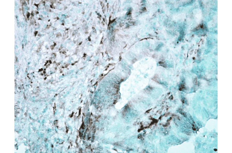 Immunohistochemistry - Anti-HSP27 Antibody [8A7] (A304709) - Antibodies.com