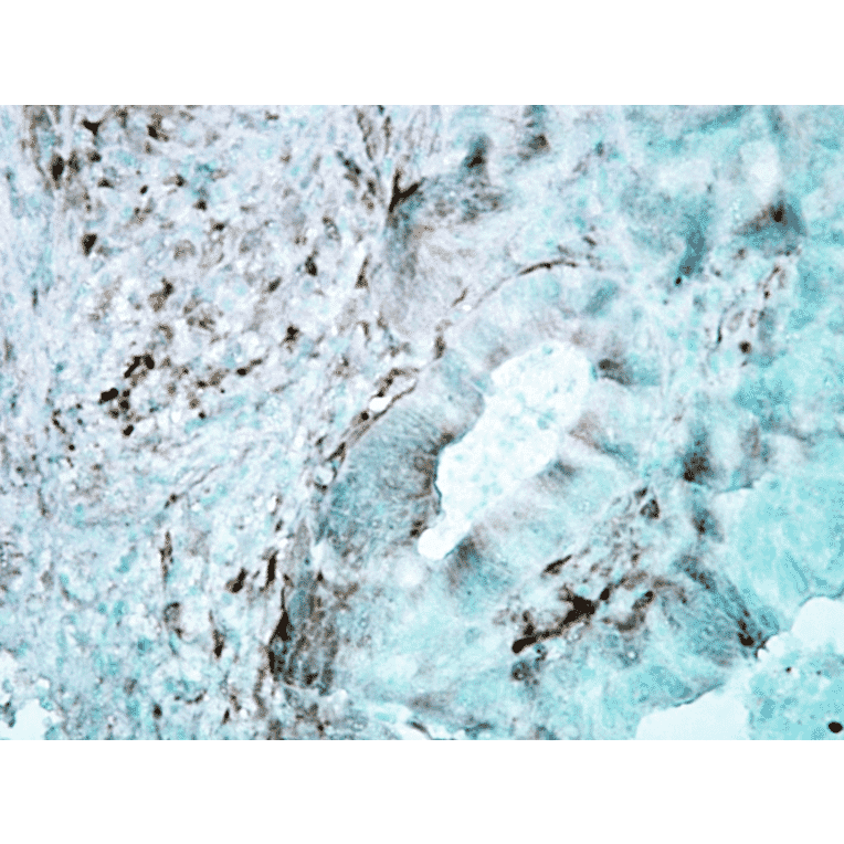 Immunohistochemistry - Anti-HSP27 Antibody [8A7] (A304709) - Antibodies.com