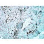 Immunohistochemistry - Anti-HSP27 Antibody [8A7] (A304709) - Antibodies.com