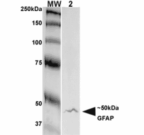 Western Blot - Anti-GFAP Antibody [S206A-8] (A304711) - Antibodies.com
