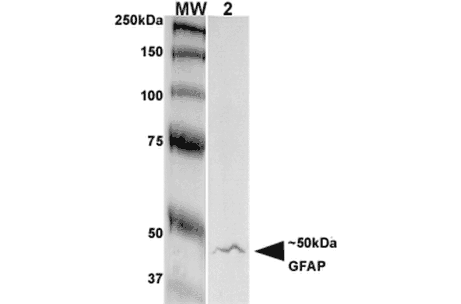 Western Blot - Anti-GFAP Antibody [S206A-8] (A304711) - Antibodies.com