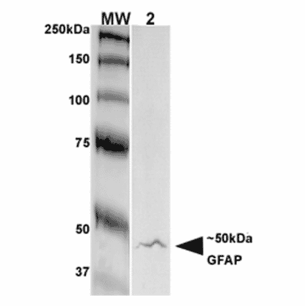 Western Blot - Anti-GFAP Antibody [S206A-8] (A304711) - Antibodies.com