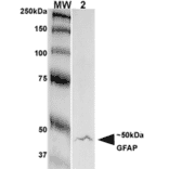 Western Blot - Anti-GFAP Antibody [S206A-8] (A304711) - Antibodies.com