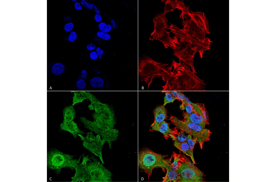 Immunocytochemistry/Immunofluorescence - Anti-GFAP Antibody [S206A-8] (A304711) - Antibodies.com