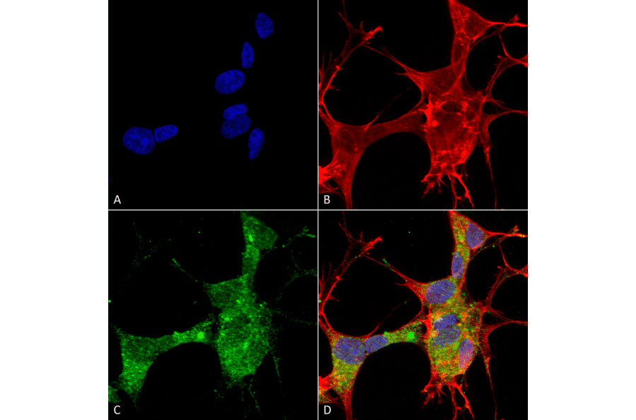 Immunocytochemistry/Immunofluorescence - Anti-GFAP Antibody [S206A-8] (A304711) - Antibodies.com