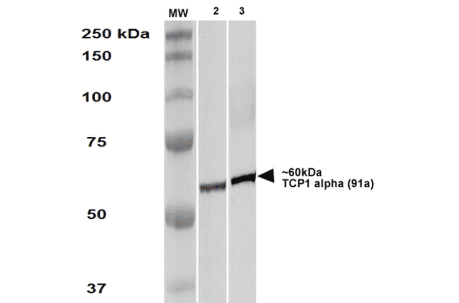 Western Blot - Anti-TCP1 alpha / CCTA Antibody [91a] (A304713) - Antibodies.com