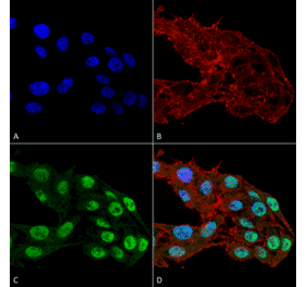 Immunocytochemistry/Immunofluorescence - Anti-DNMT1 Antibody [11H8] (A304714) - Antibodies.com